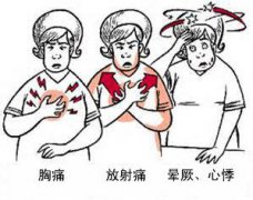 冠心病有哪些癥狀？