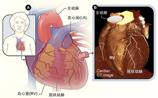 冠心病需要做哪些檢查？(圖2)