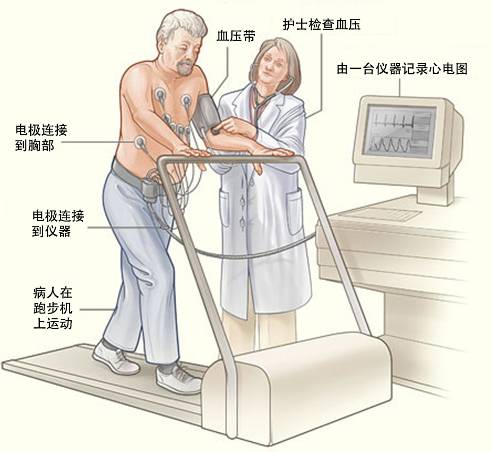 冠心病需要做哪些檢查？(圖3)